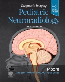 Image for Diagnostic Imaging: Pediatric Neuroradiology