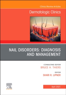 Nail Disorders: Diagnosis and Management, An Issue of Dermatologic Clinics