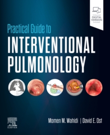 Practical Guide to Interventional Pulmonology