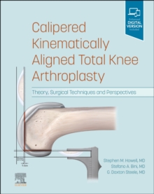 Image for Calipered kinematically aligned total knee arthroplasty  : theory, surgical techniques and perspectives