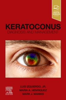 Image for Keratoconus
