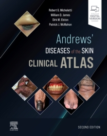 Andrews’ Diseases of the Skin Clinical Atlas