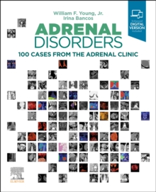 Adrenal Disorders: 100 Cases from the Adrenal Clinic