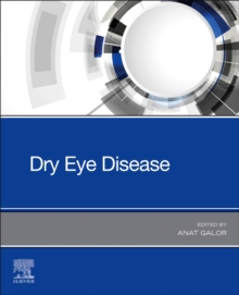 Image for Dry Eye Disease