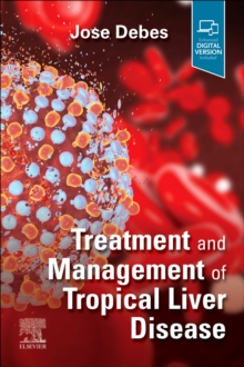 Image for Treatment and management of tropical liver disease