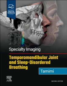 Image for Specialty Imaging: Temporomandibular Joint and Sleep-Disordered Breathing