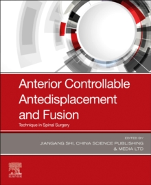 Anterior Controllable Antedisplacement and Fusion: Technique in Spinal Surgery