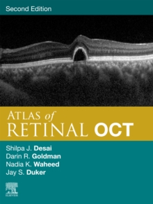 Image for Atlas of Retinal OCT E-Book: Optical Coherence Tomography