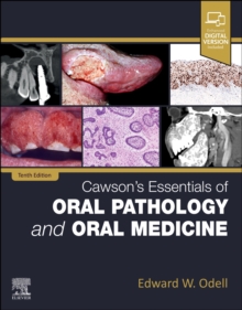 Image for Cawson's essentials of oral pathology and oral medicine