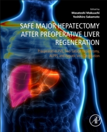 Image for Safe major hepatectomy after preoperative liver regeneration  : preopearative PVE, two-satage hepatetomy, ALPPS and hepatic vein deprivation