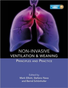 Image for Non-invasive Ventilation and Weaning: Principles and Practice