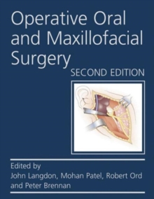 Image for Operative Oral and Maxillofacial Surgery Second edition