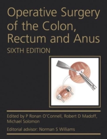 Image for Operative Surgery of the Colon, Rectum and Anus