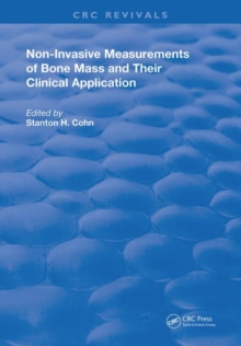 Non-Invasive Measurements of Bone Mass & Their Clinical Application