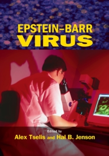Image for Epstein-Barr virus  : diagnosis, therapy, and management