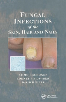 Image for Fungal Infections of the Skin and Nails