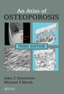 Image for An Atlas of Osteoporosis