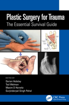 Plastic Surgery for Trauma: The Essential Survival Guide