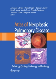 Image for Atlas of neoplastic pulmonary disease: pathology, cytology, endoscopy and radiology