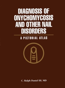 Image for Diagnosis of Onychomycosis and Other Nail Disorders