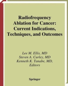 Image for Radiofrequency Ablation for Cancer