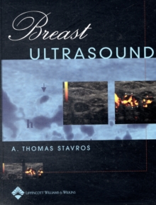 Image for Breast ultrasound