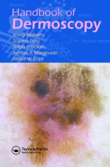 Image for Handbook of Dermoscopy