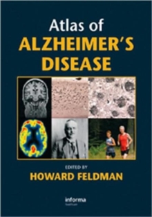 Image for Atlas of Alzheimer's Disease