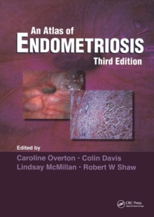 Image for Atlas of Endometriosis