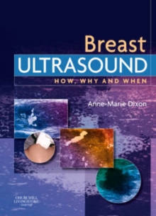 Image for Breast Ultrasound