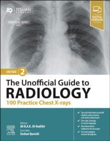 Image for The unofficial guide to radiology  : 100 practice chest x-rays