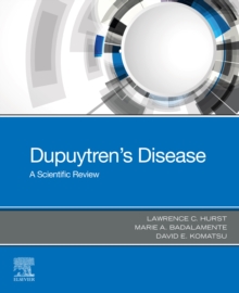 Image for Dupuytren's Disease: A Scientific Review