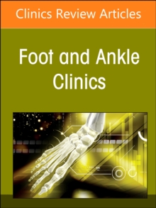 Image for Updates on total ankle replacement