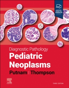 Image for Pediatric neoplasms