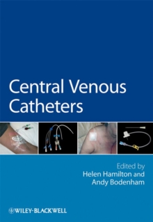 Image for Central Venous Catheters