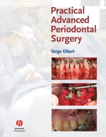 Image for Practical Advanced Periodontal Surgery