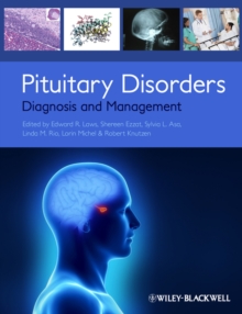 Image for Pituitary disorders  : diagnosis and management