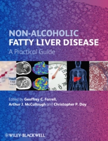 Image for Non-Alcoholic Fatty Liver Disease