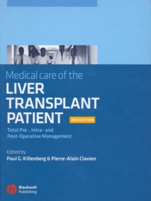 Image for Medical care of the liver transplant patient, 3E: total pre-, intra- and post operative management