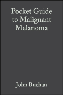 Image for Pocket guide to malignant melanoma