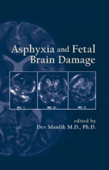Image for Asphyxia and Fetal Brain Damage