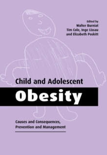 Image for Child and adolescent obesity  : causes and consequences, prevention and management