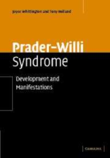 Prader-Willi Syndrome