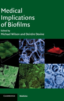 Image for Medical Implications of Biofilms
