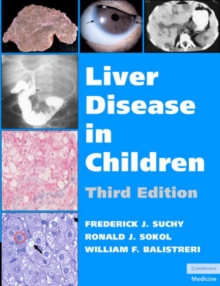 Image for Liver Disease in Children