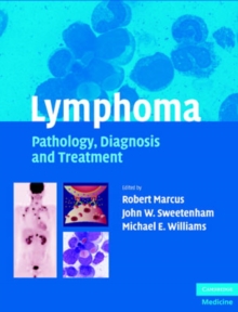 Image for Lymphoma: Pathology, Diagnosis and Treatment