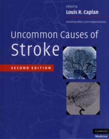 Image for Uncommon causes of stroke