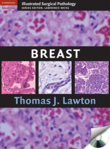 Breast