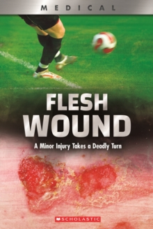 Image for Flesh Wound: A Minor Injury Takes a Deadly Turn (XBooks)