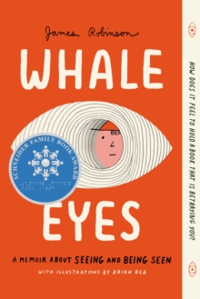 Whale Eyes